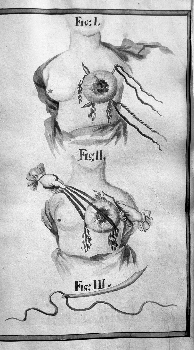 6 Phantom Sensations Beyond Limbs That Doctors Have Actually Documented