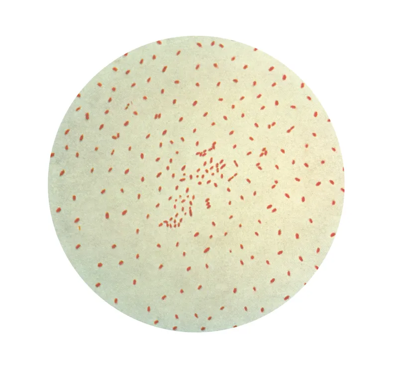 Pertactin-Deficient Bordetella pertussis Rose After Acellular Vaccines