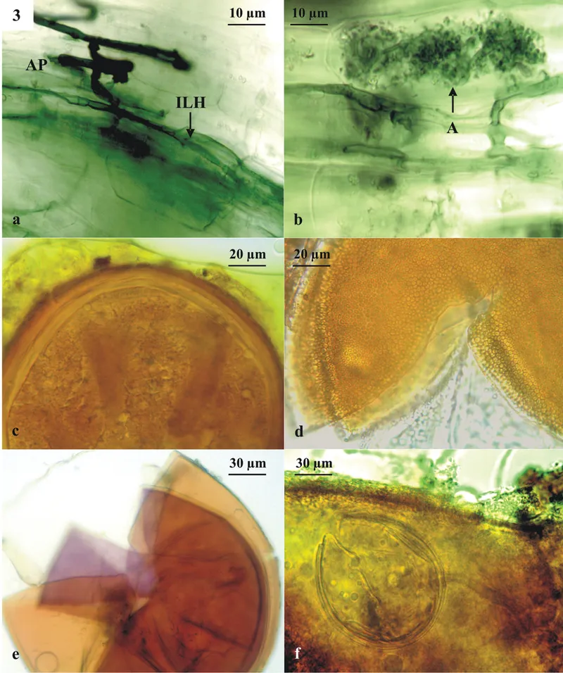 Image by Bidondo LF, Colombo RP, Recchi M, Silvani VA, Pérgola M, Martínez A, Godeas AM (2018) Detection of arbuscular mycorrhizal fungi associated with pecan (Carya illinoinensis) trees by molecular and morphological approaches. MycoKeys 42: 73-88. https://doi.org/10.3897/mycokeys.42.26118 — CC BY 4.0